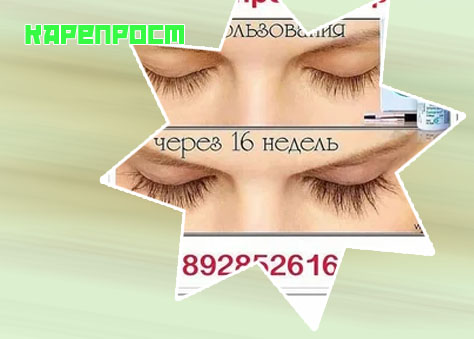 Карепрост отзывы